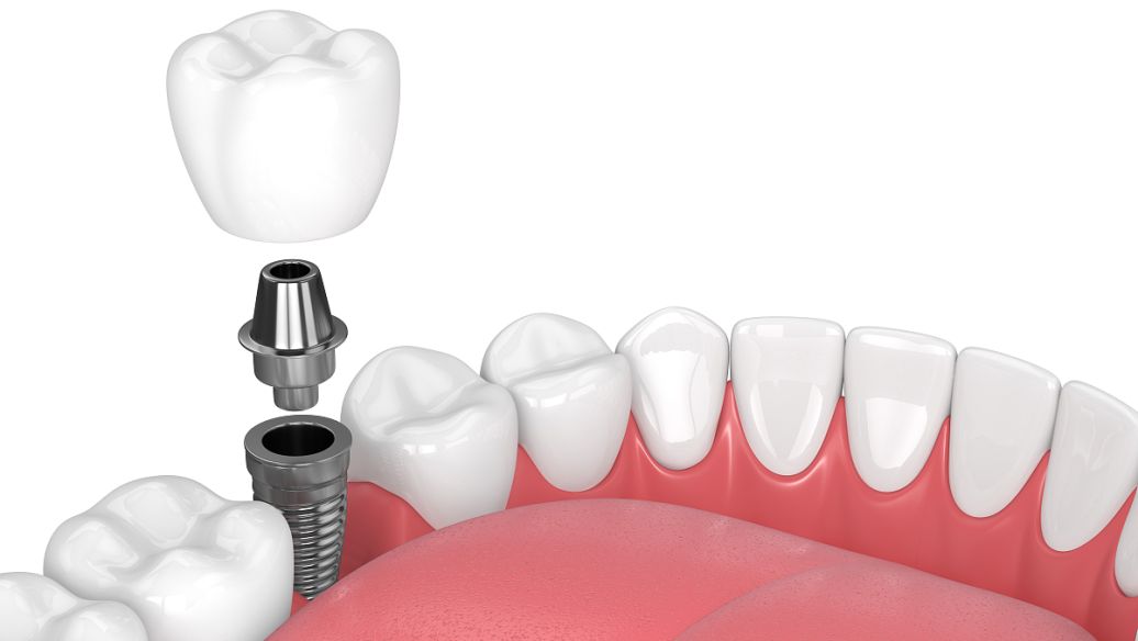 六家医院，到底怎么“闭眼入”？