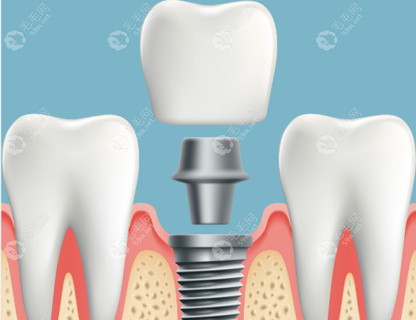 任义医生怎么样 任义医生怎么样