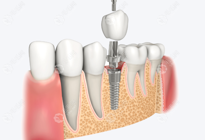 项目设置与收费透明 项目设置与收费透明