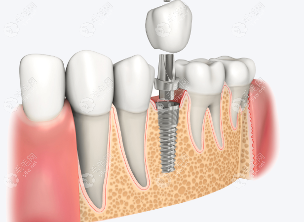任义医生怎么样 任义医生怎么样