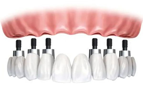 六、如何查询深圳共合口腔价格表及预约服务