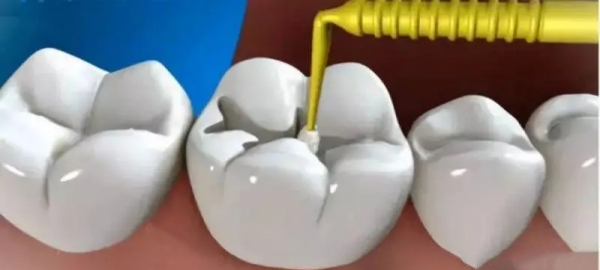 啟東北極煋口腔診所