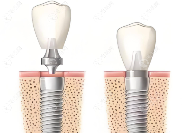 深圳新沙同步口腔诊所执业医师唐留欣