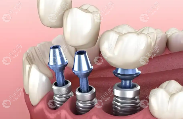 在同步齿科的技术领导角色