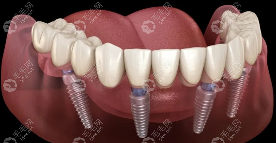 深圳博森和瑞口腔门诊部执业医师宾自立