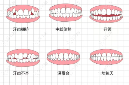如何预约舒尔医生？