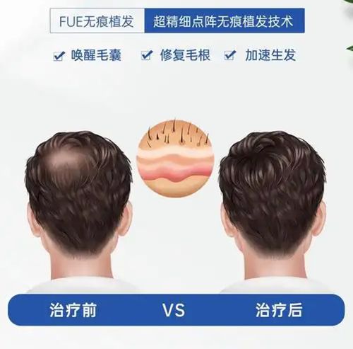 二、常见的发际线形状有哪些
