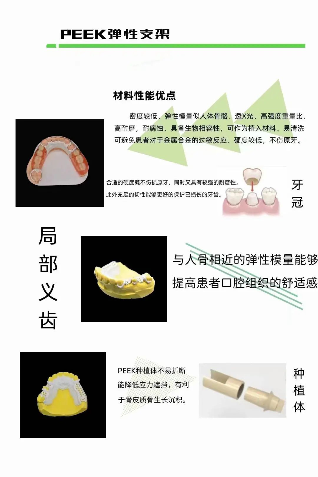 六、牙齿种植好还是做假牙好：种完之后怎么维护才能用得久