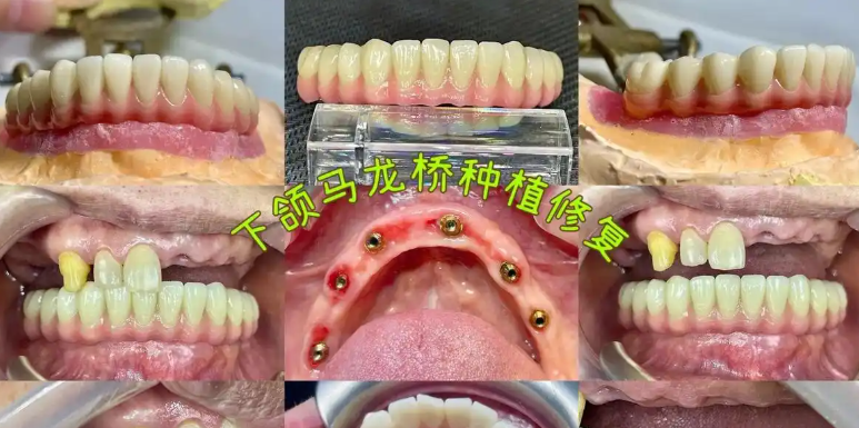 关于纯钛马龙桥架与普通桥架的区别，用户较常问的几个问题（FAQ）