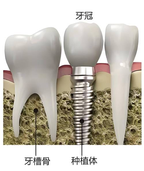 五、去昆山柠檬口腔前，必看的5个避坑FAQ