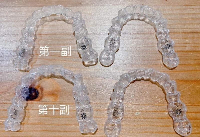 二、隐形矫正实例征集是怎么回事？我需要给诊所当模特吗？
