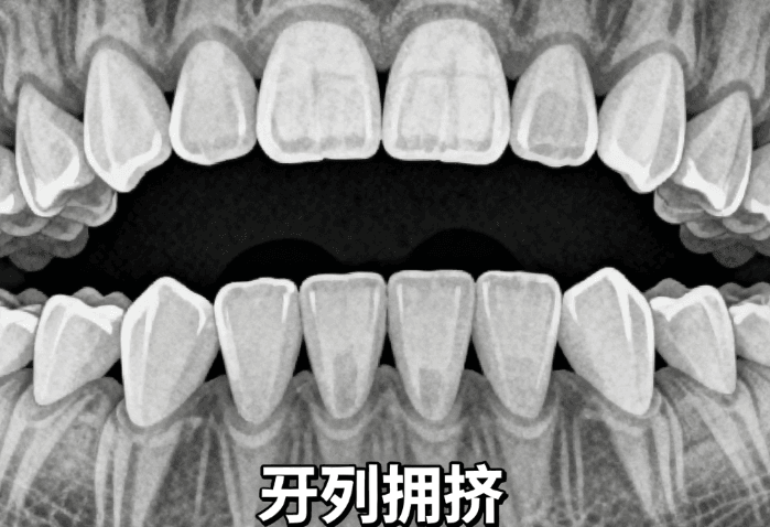 榆林中诺口腔医院正畸价格表2026版出炉！金属自锁7880元起+隐形矫正15000元起