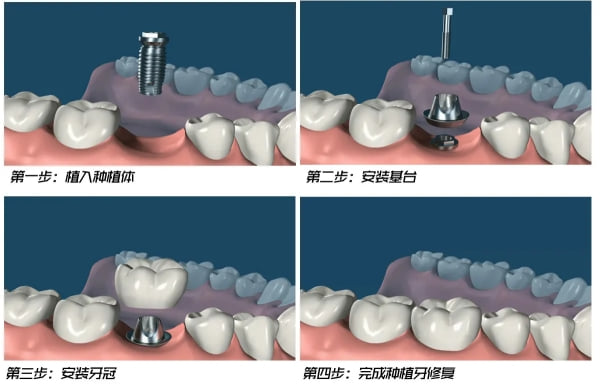 五、常见问题FAQ(你想问的应该都在这里)