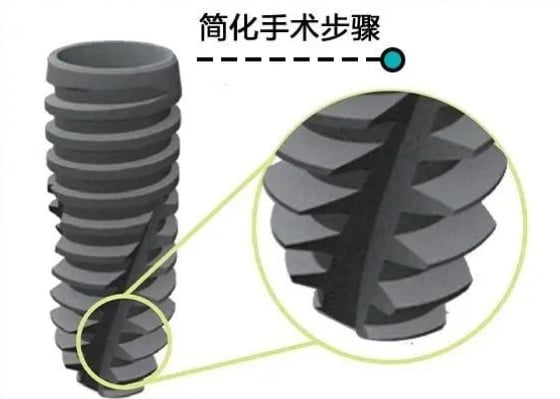 唐县现化口腔怎么样？种牙报价透明，注重性价比的街坊可冲