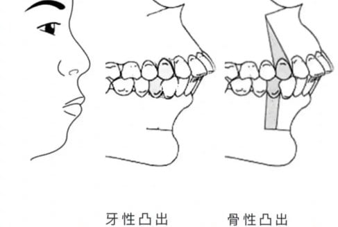 四、安荃与舒适:隐形之外,细节决定敢不敢推荐