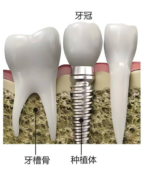 四、定州一加一口腔怎么样?患者真实反馈与选择建议