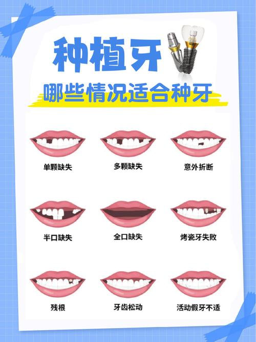 七、怎么预约更省事