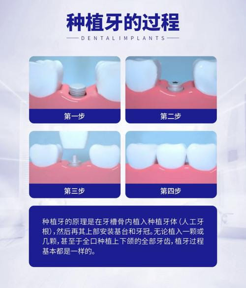 四、苏州中喜口腔服务贴心吗?预约到复诊流程体验