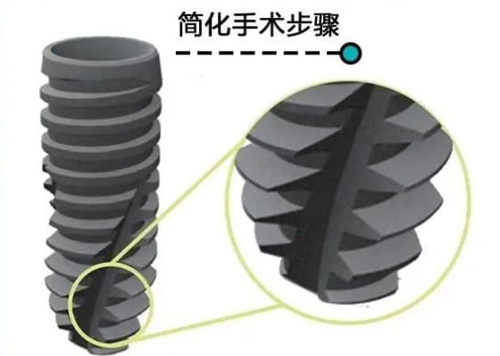 三、天津河西美澳口腔预约种牙价格大概多少?