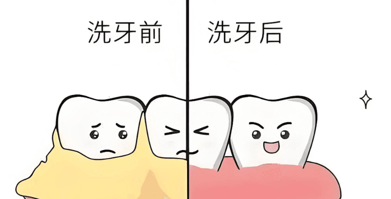 吴中和恩口腔门诊价格贵不贵｜洁牙200元起怎么理解