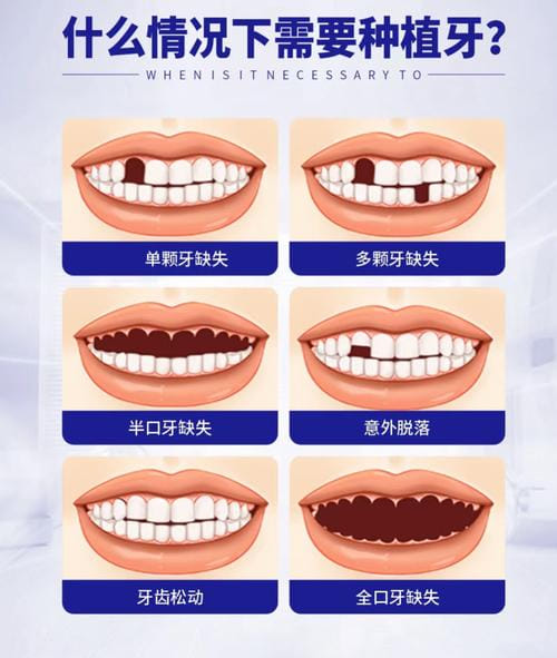 赣州阳光口腔种牙价格怎么预约确认更省事?