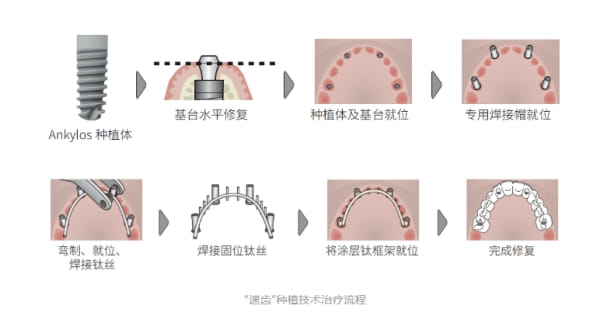 四、上海牙博士口腔收费透明吗,会不会有隐形消费