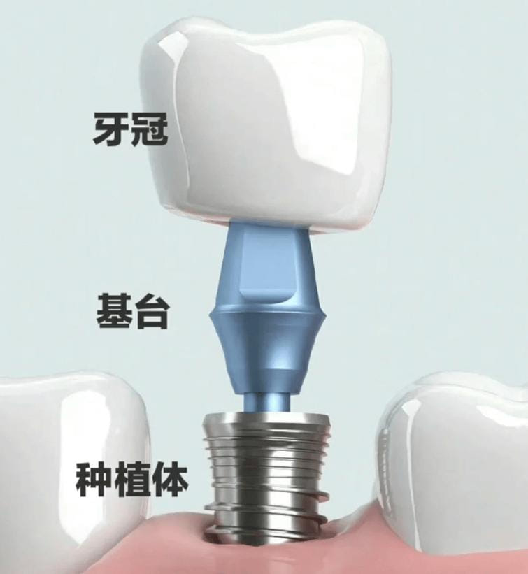 四、上海虹桥医院口腔科儿童看牙的流程和家长配合要点