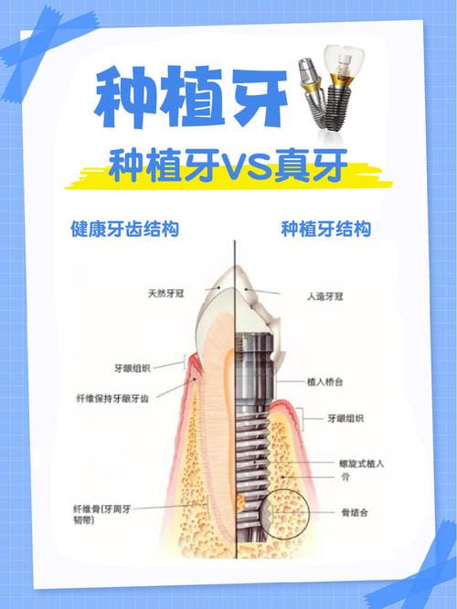 六、南阳植得口腔医院种植牙价格表的真实顾客反馈