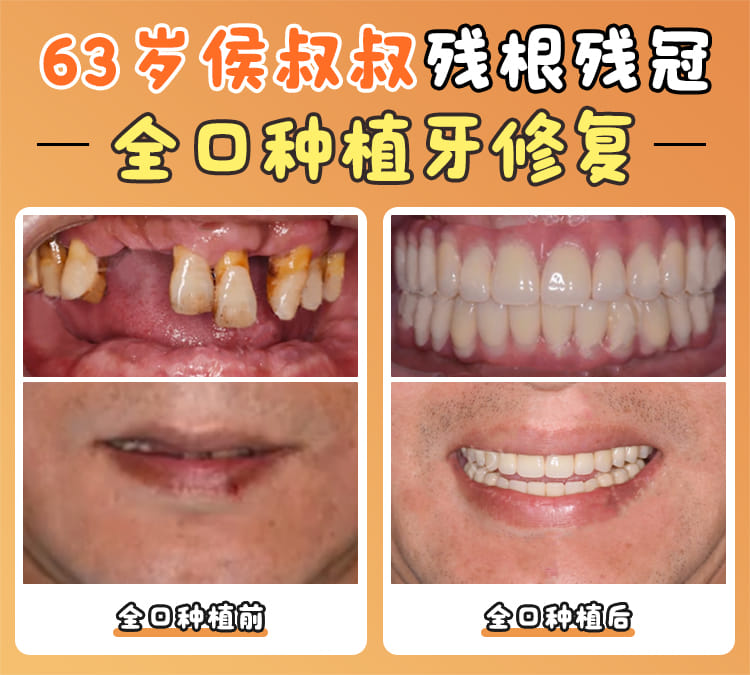 四、上海良美口腔门诊部预约到院流程怎么走