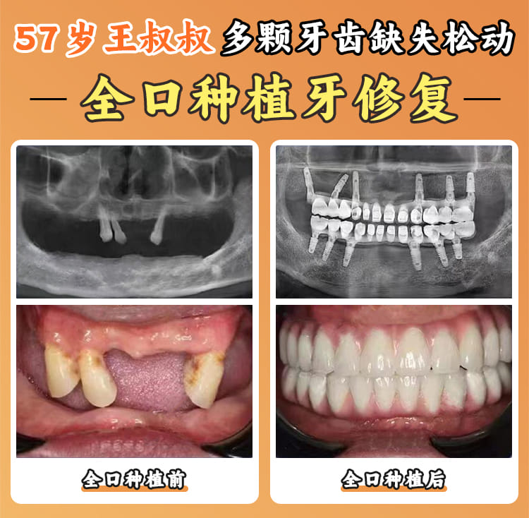 上海良美口腔门诊部怎么样？2026年实地探访：卫健委审批资质让人放心