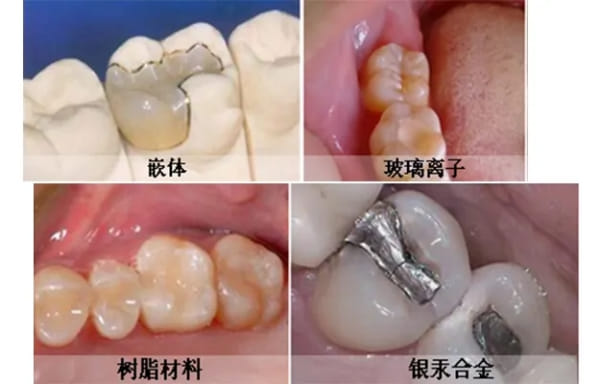 四、玉林蓝天口腔补牙回访口碑和预约流程怎么样