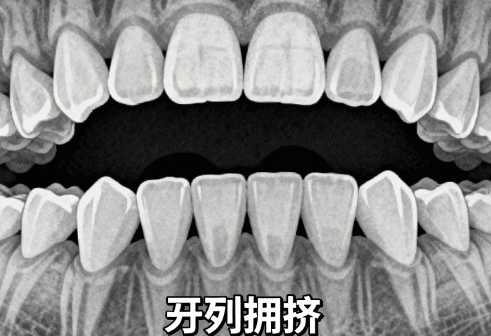 四、珠海海精灵口腔牙齿矫正的医生和方案怎么挑