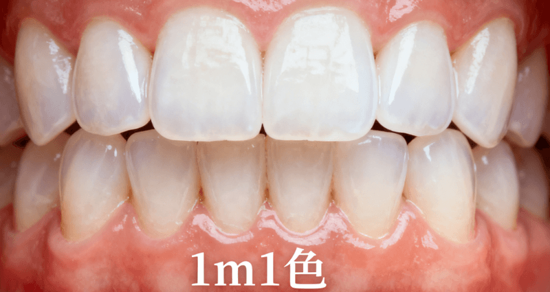 二、长春百冠口腔种植牙的费用花在哪几块